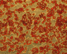 Oil Red O stained adipocytes