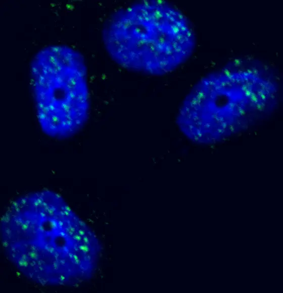 When the enzyme HIPK2 (green) is activated, the cell dies.