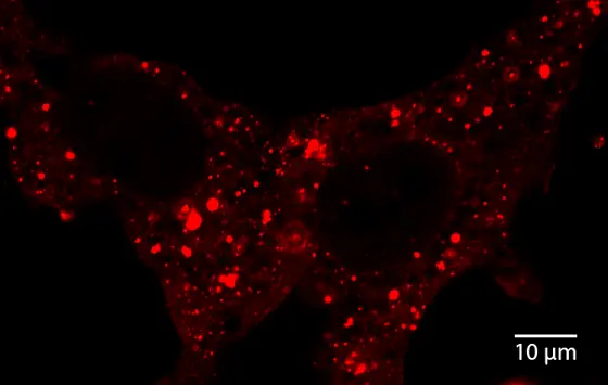 Peroxiredoxin-2 und der Transkriptionsfaktor STAT3 treffen sich in eng umgrenzten Bereichen innerhalb der Zelle (rote Fluoreszenz).