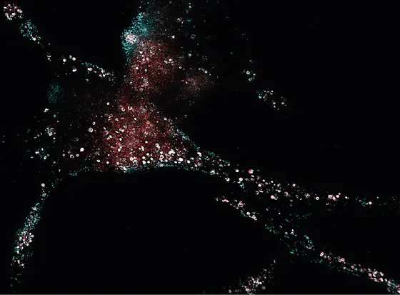 Mit der STED-Mikroskopie kann die Verteilung und Anreicherung von PSMA-bindenden Wirkstoffen (rot) in Prostatakrebszellen untersucht werden. Im Vergleich dazu: Die Verteilung von PSMA (cyan).