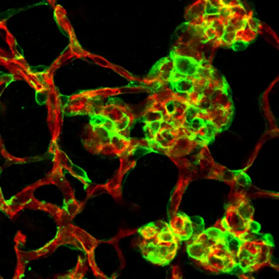 Immature vessels sprouting during premature retinopathy (red: endothelial cells; green: mural cells (pericytes))