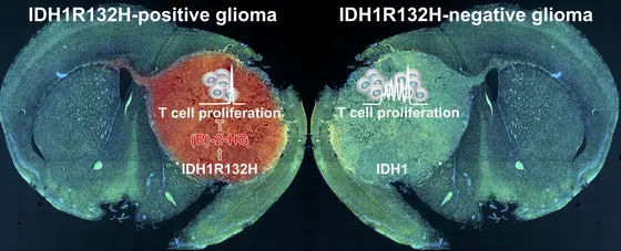 Mutierte IDH1: Der Austausch einer einzigen Aminosäure blockiert die körpereigene Abwehr und vereitelt Immuntherapien von Hirntumoren.