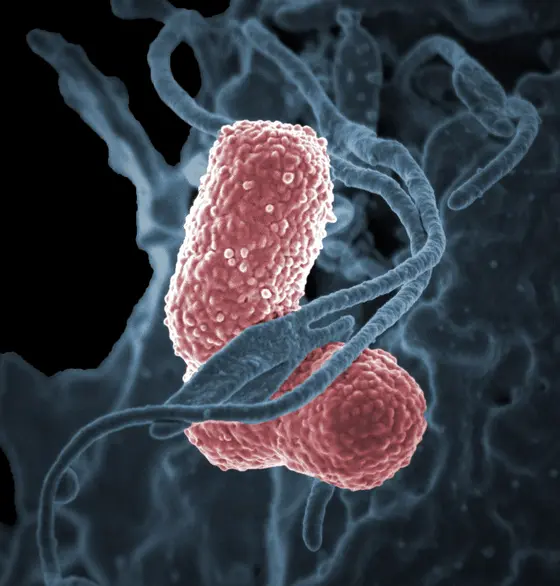 The common pathogen Klebsiella pneumoniae