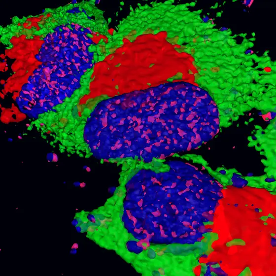 3D-Rekonstruktion einer Lungenkrebszelle