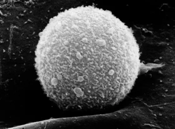 Tregs and helper T cells are lymphocytes (Scanning electron micrograph)