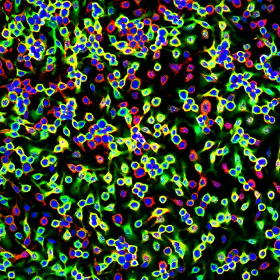 Fluorescence microscopy picture of bone marrow-derived macrophages: red: macrophage marker / blue: DNA /green: ferritin.