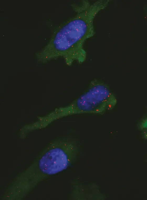 A cancer cell displaying tumor antigens at its surface. The red dots indicate where MCH molecules and tumor antigen co-locate.