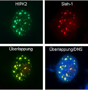 Das HIPK2 Protein (grün) und sein Abbaufaktor Siah-1 (rot) treffen sich (gelb) im Zellkern (blau)