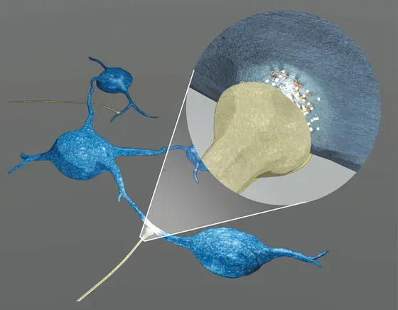 Graphic presentation of the newly discovered mechanism by which neurons (brown) promote growth of brain tumor cells (blue).