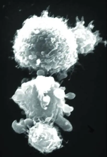 Tumor cells coated with bispecific antibodies are attacked and killed by activated T-cells