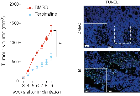 Die Grafik zeigt das Wachstum von Prostatakarzinomzellen mit und ohne Behandlung mit dem SQLE-Hemmstoff Terbinafin. Die Bilder demonstrieren das Absterben von Tumorzellen nach Behandlung mit Terbinafin. Dies wird durch die große Zahl an grünen Strukturen, einem Marker für Zelltod, dargestellt.