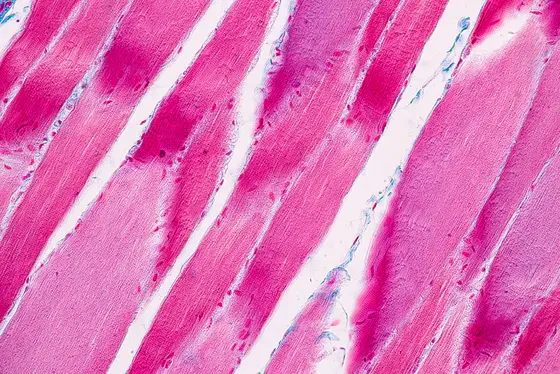 Sceletal muscle seen through a light microscope