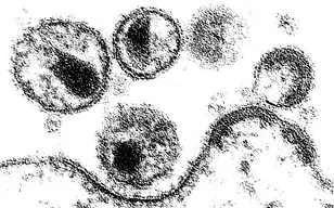 Elektronenmikroskopische Aufnahme von Aidsviren an der Membran einer ZelleFotograf: Professor Hanswalter Zentgraf, Deutsches Krebsforschungszentrum