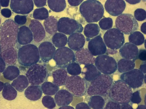 Microscopic image showing a cluster of round cells with varying sizes and shades of purple. The background is lighter, highlighting the distinct cell structures. This image is likely related to hematological studies or cellular biology.