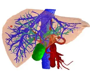 Three-dimensional image of a liver with blood vessels (red and blue), bile ducts and gallbladder (green). Source: Prof. Dr. Hans-Peter Meinzer, Deutsches Krebsforschungszentrum