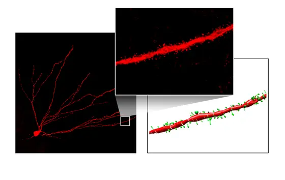 Granule cells connect with other cells via long projections (dendrites). The actual junctions (synapses) are located on thorn-like protuberances called "spines". Spines are shown in green in the computer reconstruction.