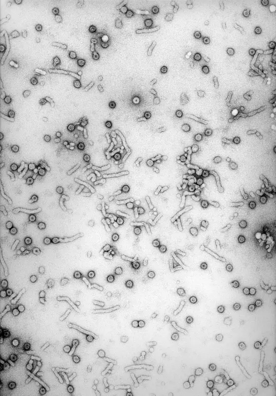 Electron microscopic picture of hepatitis B viruses