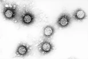 Electron-microscopical image of human papilloma viruses. Source: Prof. Hanswalter Zentgraf, Deutsches Krebsforschungszentrum