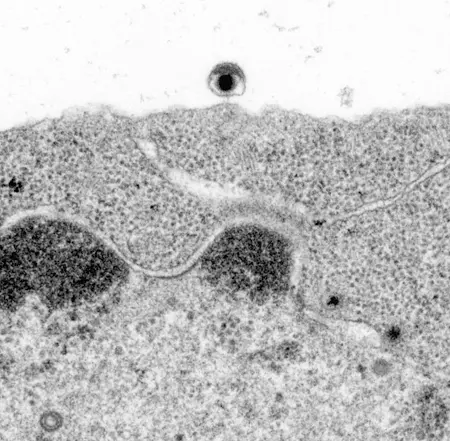 Epstein-Barr Virus beim Verlassen einer Zelle (elektronenmikroskopische Aufnahme)