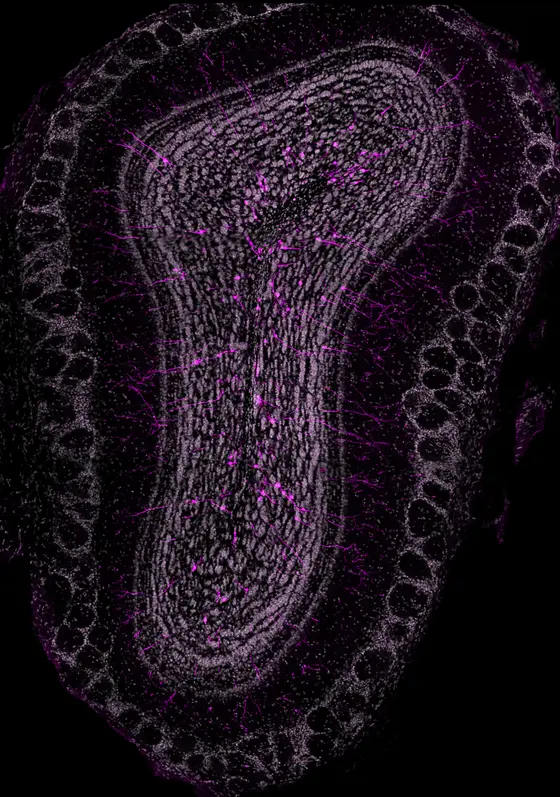 Olfactory bulb interneurons generated out of neural stem cells transplanted in the walls of the lateral ventricles.