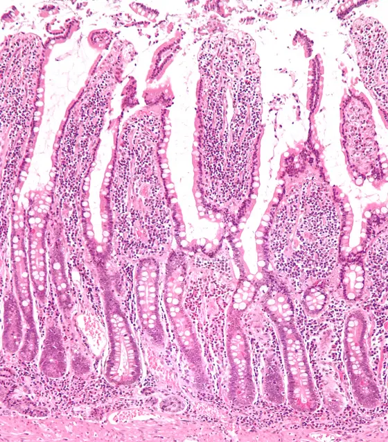 Intestinal stem cells are located deep at the bottom of the intestinal crypts.