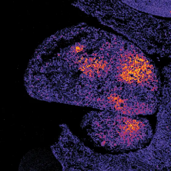 Oxidantienbildung in der Leber – mit einem neuen Biosensor auf einem Gewebeschnitt sichtbar gemacht.