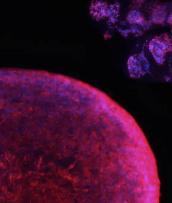 The image shows a collage of fluorescently labeled tumor organoids grown from patient cells in the Scheffler lab as a "mini brain tumor" for research.