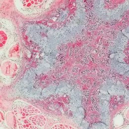 Research Topic Cell and Tumor Biology A microscopic image showcases a layered tissue structure predominantly in shades of pink and purple. It features various cell types, including round and oval shapes, interspersed with background textures, highlighting the complexity of biological samples.