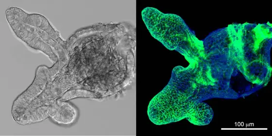 Mini-Därme zeigen essentielle Funktionen und molekulare Prozesse eines echten Darms. Der Botenstoff Wnt (grün) wird auf die Zellmembran der Stammzellen geladen und an die Membranen der Tochterzellen weitergegeben.