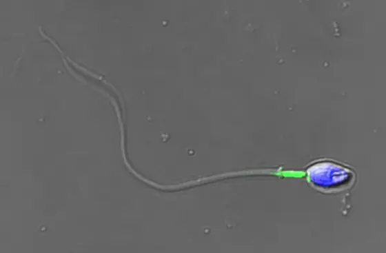 A human sperm cell: The active Wnt receptor is dyed green, the nucleus is dyed blue.