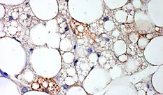 Brown fat cells within white fat tissue