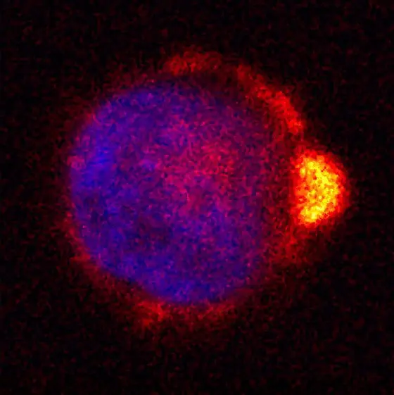 A human melanoma cell exhibits a specific polarity which helps attaching to the endothelial layer of the blood vessel (ezrin stained in orange)