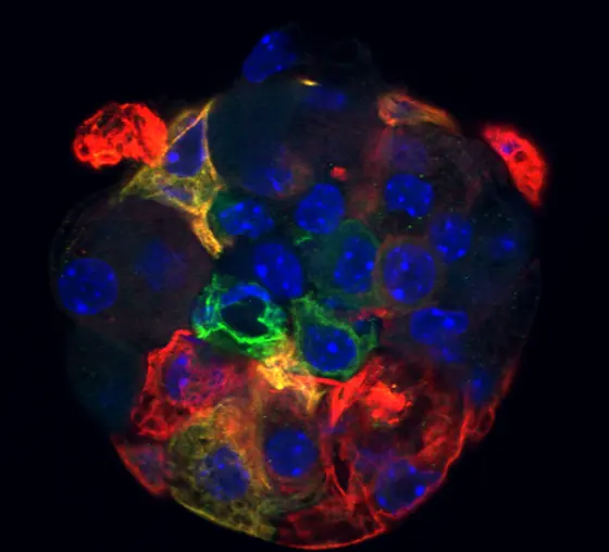 Sphere forming cells in the thymus give rise to both cortical (red) and medullary (green) thymic epithelial cells.