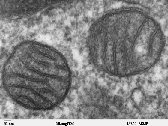 Mitochondria from mammalian lung tissue as shown by electron microscopy.