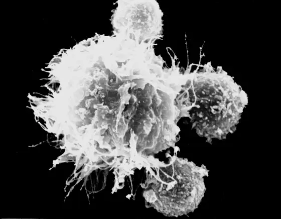 Cancer often inhibits the body’s own immune system (here a dendritic cell surrounded by T cells)