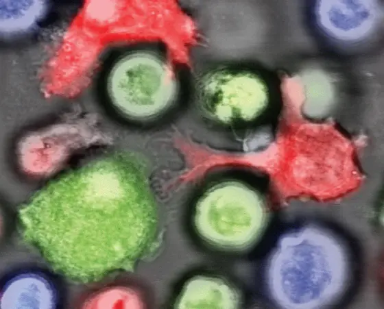 NK cells (red) attack normal leukemia cells (green). Leukemia stem cells (blue), on the other hand, suppress NKG2DL expression at their surface and thus escape destruction by the immune system.