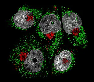 In cancer cells treated with arsenuate, mitochondria (green) as well as lysosomae (red) appear fragmented, accummulated around the nuclei. Untreated cancer cells, in contrast, appear to have a network of mitochondria and lysosomae distributed evenly over the entire cell.