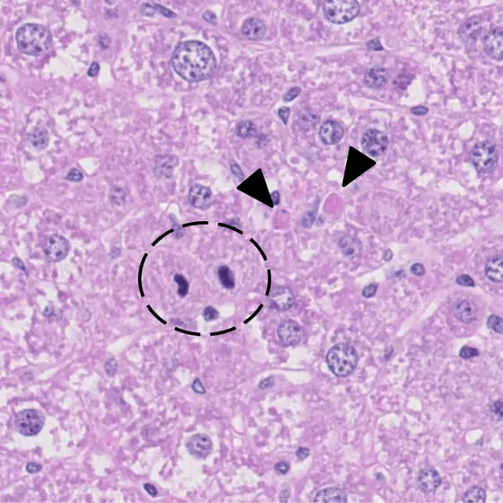 Ein Modell für chronische Lebererkrankung: Die Leberzellen der Maus sind genetisch so modifiziert, dass sie besonders häufig an Apoptose sterben. Apoptotische Zellen sind durch Pfeile gekennzeichnet, im Kreis sind teilende Zellen erkennbar.