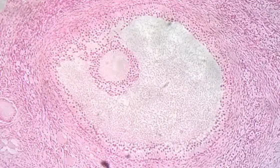 Ovarian follicle