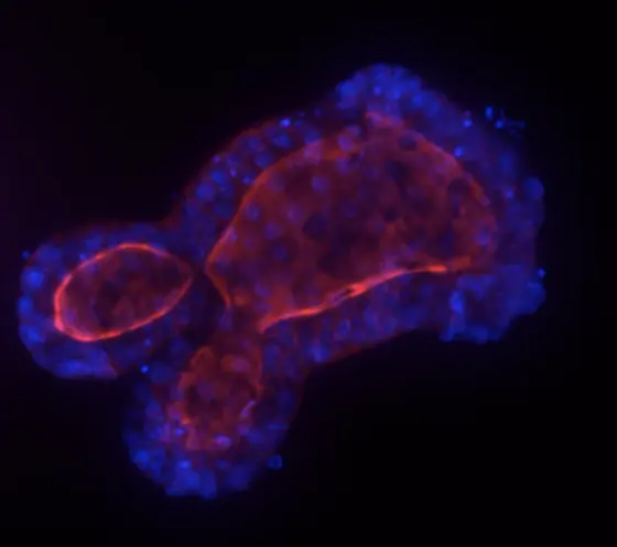 Three-dimensional organoids ("mini tumors") can be grown in the culture dish from tissue samples of colon cancer. Organoids are ideal to test the effectiveness of drugs.