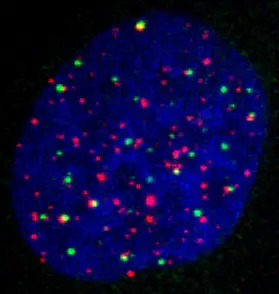 In some cancer cells, APB complexes (yellow) induce the extension of the telomere repeats (red).