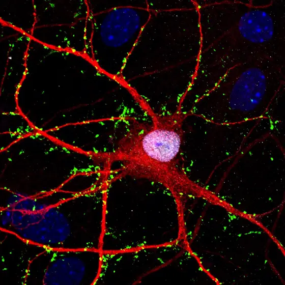 Human brain cells programmed from stem cells in the culture dish (red, green).