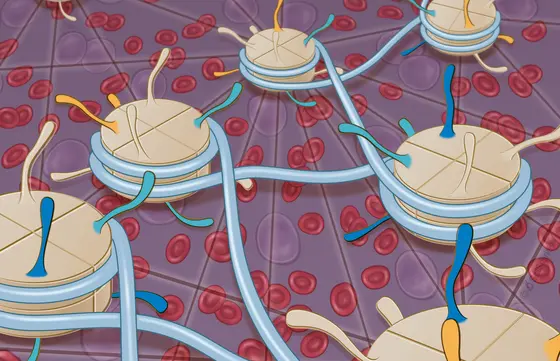 Ein Netzwerk von falschen epigenetischen Signalen an den Histonproteinen und der DNA führt in Zellen der chronisch-lymphatischen Leukämie zu Fehlern beim Auslesen der Erbinformation.