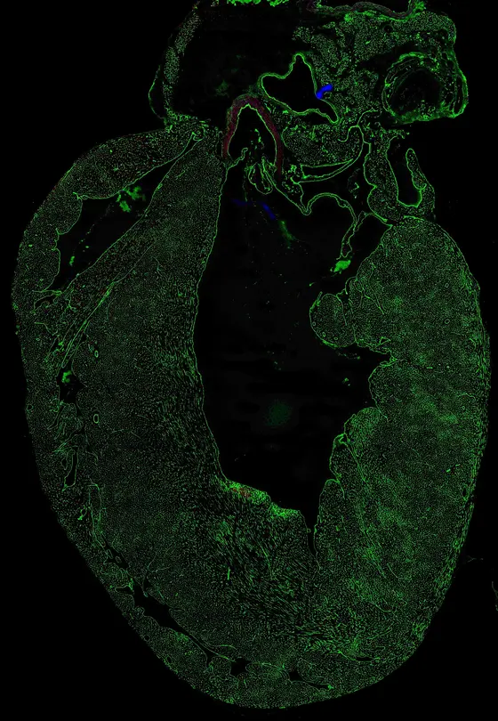 Tissue section of a mouse heart: Blood vessels are stained green.