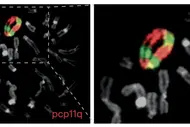 CK-AML chromosomes even form ring-shaped structures