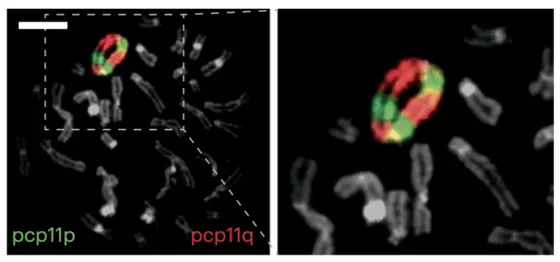 CK-AML chromosomes even form ring-shaped structures