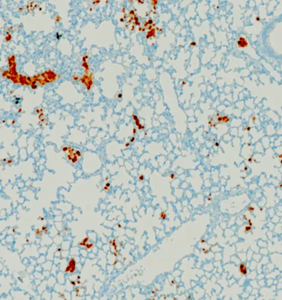 Metastase eines Neuroblastoms in einem Maus-Modell