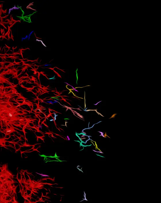 Einblicke in die Ausbreitungsmechanismen eines Hirntumors: invasive Tumorzellen (farbig) imitieren Eigenschaften und Bewegungsmuster von Nervenzell-Vorläufern und dringen in das gesunde Hirngewebe (schwarz) ein.