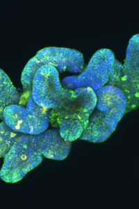 A cluster of cellular structures illuminated with fluorescent colors, predominantly blue and green, resembling abstract shapes. The background is black, enhancing the contrast and visibility of the vibrant cellular forms. The image highlights biological elements, possibly related to microscopic studies or research.